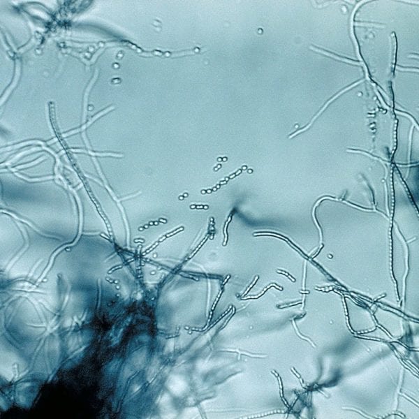 WHAT THEY LEARNED: Erin Berlew ’15