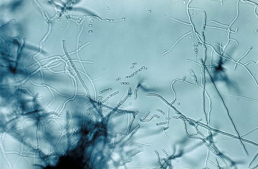 WHAT THEY LEARNED: Erin Berlew ’15