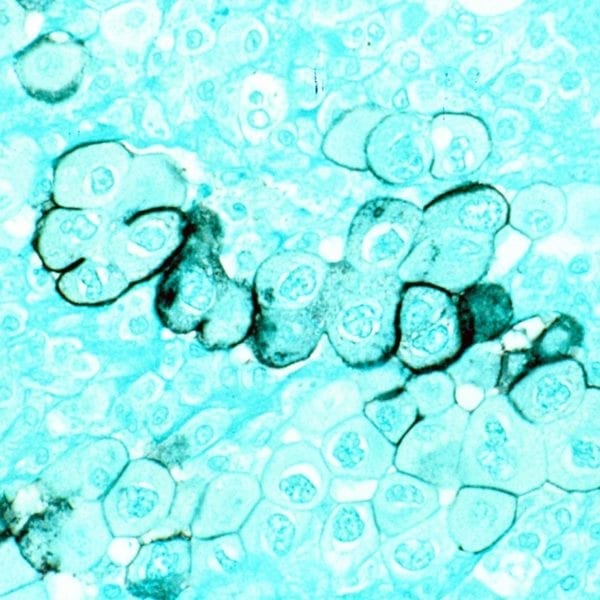 What They Learned: Jessica Koshinski ’18